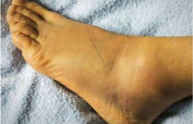 ۸ بیماری جدی که از پاهایتان تشخیص داده می‌شوند